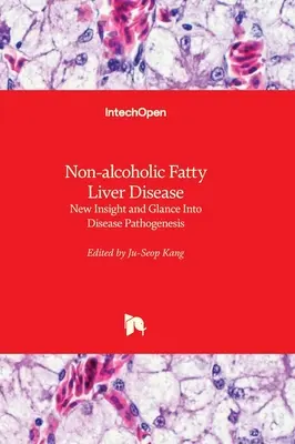 Nem alkoholos zsírmájbetegség - Új betekintés és pillantás a betegség patogenezisébe - Non-alcoholic Fatty Liver Disease - New Insight and Glance Into Disease Pathogenesis