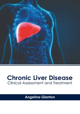 Krónikus májbetegség: Klinikai értékelés és kezelés - Chronic Liver Disease: Clinical Assessment and Treatment