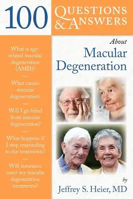 100 kérdés és kérdés a makuladegenerációról - 100 Q&as about Macular Degeneration