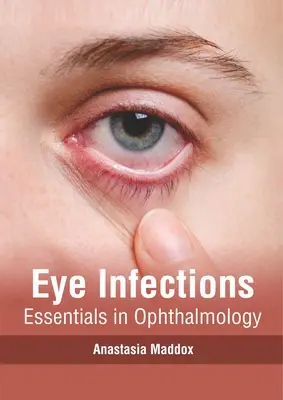 Szemfertőzések: A szemészet alapjai - Eye Infections: Essentials in Ophthalmology