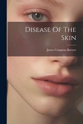 A bőr betegségei - Disease Of The Skin