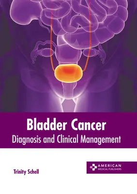 Hólyagrák: Diagnózis és klinikai kezelés - Bladder Cancer: Diagnosis and Clinical Management