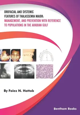 A Thalassemia Major orofaciális és szisztémás jellemzői: kezelés és megelőzés az Arab-öbölben élő népességre vonatkoztatva - Orofacial and Systemic Features of Thalassemia Major: Management, and Prevention with Reference to Populations in the Arabian Gulf