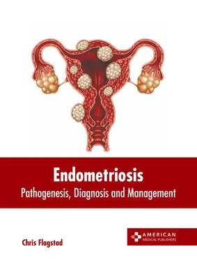 Endometriózis: Patogenezis, diagnózis és kezelés - Endometriosis: Pathogenesis, Diagnosis and Management