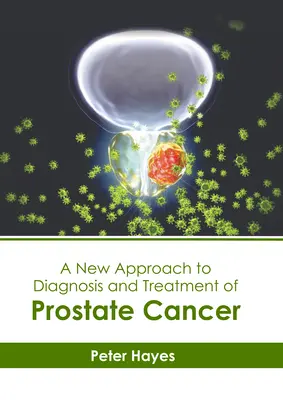 A prosztatarák diagnózisának és kezelésének új megközelítése - A New Approach to Diagnosis and Treatment of Prostate Cancer