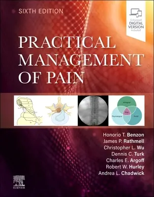 A fájdalom gyakorlati kezelése - Practical Management of Pain