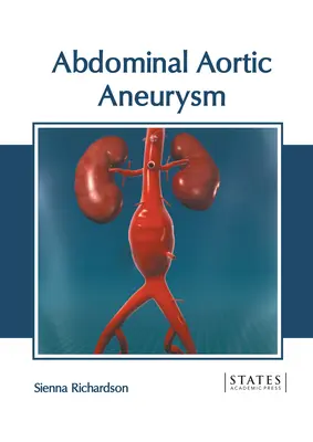 Hasi aorta aneurizma - Abdominal Aortic Aneurysm