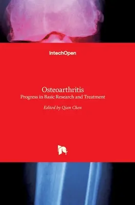 Osteoarthritis: Az alapkutatás és a kezelés terén elért haladás - Osteoarthritis: Progress in Basic Research and Treatment