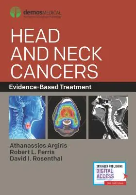 Fej- és nyaki rákos megbetegedések: Evidencia-alapú kezelés - Head and Neck Cancers: Evidence-Based Treatment