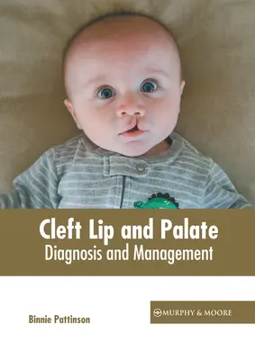 Az ajak- és szájpadhasadék: Diagnózis és kezelés - Cleft Lip and Palate: Diagnosis and Management