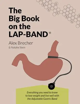 A Lap-Band nagykönyve: Minden, amit tudnia kell a fogyáshoz és a jó élethez az állítható gyomorszalaggal - The Big Book on the Lap-Band: Everything You Need to Know to Lose Weight and Live Well with the Adjustable Gastric Band