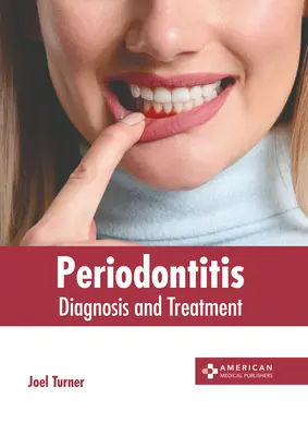 Periodontitis: Diagnózis és kezelés - Periodontitis: Diagnosis and Treatment