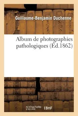 Album de Photographies Pathologiques, Complmentaire Du Livre Intitul de l'lectrisation Localise