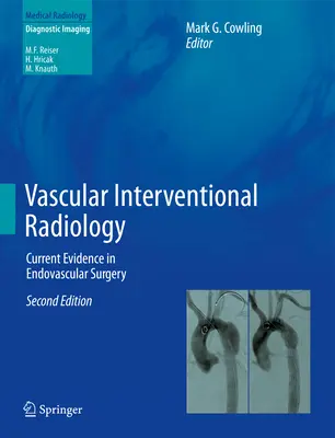 Érrendszeri intervenciós radiológia: Az endovaszkuláris sebészet aktuális bizonyítékai - Vascular Interventional Radiology: Current Evidence in Endovascular Surgery