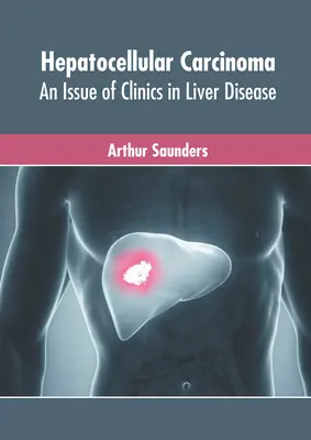 Hepatocelluláris karcinóma: A Clinics in Liver Disease (Májbetegségek klinikái) című folyóirat kiadványa - Hepatocellular Carcinoma: An Issue of Clinics in Liver Disease