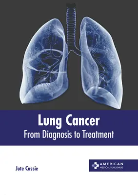 Tüdőrák: A diagnózistól a kezelésig - Lung Cancer: From Diagnosis to Treatment