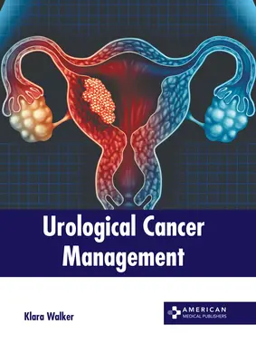 Urológiai rákkezelés - Urological Cancer Management