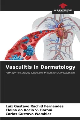 Vaszkulitisz a bőrgyógyászatban - Vasculitis in Dermatology
