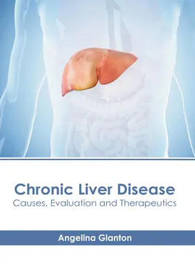 Chronic Liver Disease: Májbetegség: Okok, értékelés és terápia - Chronic Liver Disease: Causes, Evaluation and Therapeutics