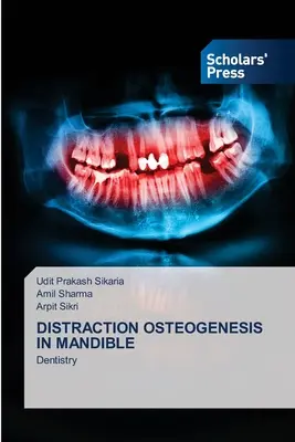 Distrakciós csontképzés az állkapocsban - Distraction Osteogenesis in Mandible