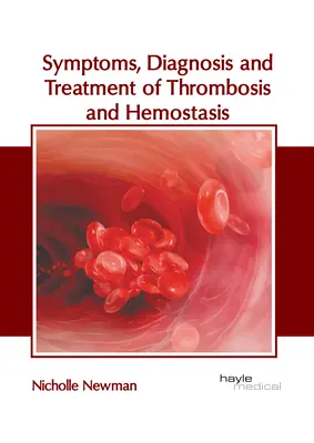 A trombózis és a hemosztázis tünetei, diagnózisa és kezelése - Symptoms, Diagnosis and Treatment of Thrombosis and Hemostasis