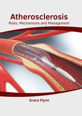 Atherosclerosis: Atherclerosis: Kockázatok, mechanizmusok és kezelés - Atherosclerosis: Risks, Mechanisms and Management