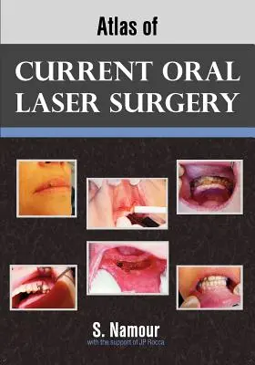 A jelenlegi szájsebészeti lézersebészet atlasza - Atlas of Current Oral Laser Surgery