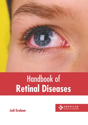 A retina betegségeinek kézikönyve - Handbook of Retinal Diseases