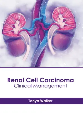 Vesesejtes karcinóma: klinikai kezelés - Renal Cell Carcinoma: Clinical Management