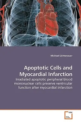 Apoptotikus sejtek és szívinfarktus - Apoptotic Cells and Myocardial Infarction