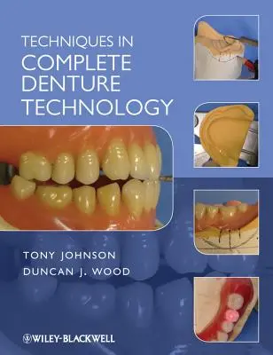 A teljes fogpótlás technikái - Techniques in Complete Denture