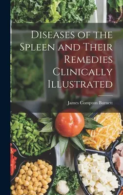 A lép betegségei és gyógymódjaik klinikailag illusztrálva - Diseases of the Spleen and Their Remedies Clinically Illustrated