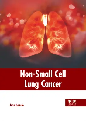 Nem kissejtes tüdőrák - Non-Small Cell Lung Cancer