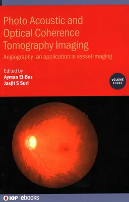 Fotóakusztikus és optikai koherencia tomográfiás képalkotás: Angiográfia: - Alkalmazás az erek képalkotásában - Photo Acoustic and Optical Coherence Tomography Imaging: Angiography: - An Application in Vessel Imaging