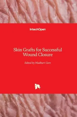 Bőrátültetés a sikeres sebzáráshoz - Skin Grafts for Successful Wound Closure