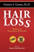 Hajhullás, második kiadás: A helyreállítás és visszafordítás lehetőségei - Hair Loss, Second Edition: Options for Restoration & Reversal