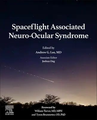 Az űrrepüléssel összefüggő neuro-szemészeti szindróma - Spaceflight Associated Neuro-Ocular Syndrome