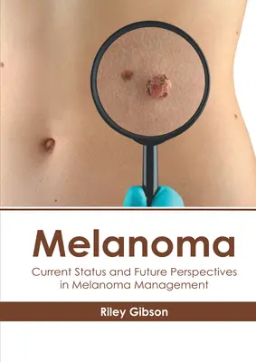 Melanoma: A melanoma kezelésének jelenlegi helyzete és jövőbeli kilátásai - Melanoma: Current Status and Future Perspectives in Melanoma Management