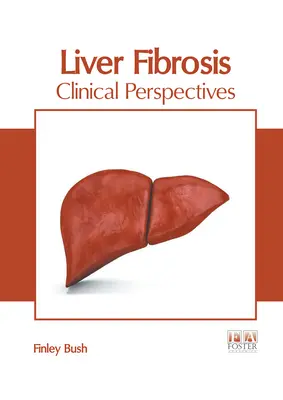 Májfibrózis: Klinikai perspektívák - Liver Fibrosis: Clinical Perspectives