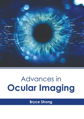 Fejlemények a szemészeti képalkotásban - Advances in Ocular Imaging