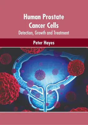 Emberi prosztatarákos sejtek: A prosztatagyulladás: kimutatás, növekedés és kezelés - Human Prostate Cancer Cells: Detection, Growth and Treatment