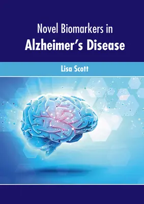 Új biomarkerek az Alzheimer-kórban - Novel Biomarkers in Alzheimer's Disease