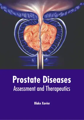 Prosztata betegségek: Prosztata: Értékelés és terápia - Prostate Diseases: Assessment and Therapeutics