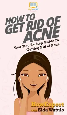 Hogyan szabadulj meg a pattanásoktól: A lépésről lépésre útmutató a pattanásoktól való megszabaduláshoz - How To Get Rid of Acne: Your Step By Step Guide To Getting Rid of Acne