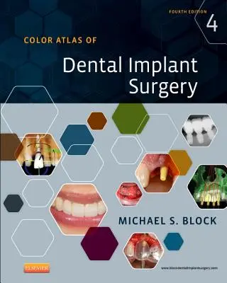 A fogászati implantációs sebészet színes atlasza - Color Atlas of Dental Implant Surgery