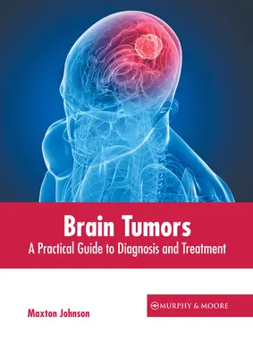 Agydaganatok: Gyakorlati útmutató a diagnózishoz és kezeléshez - Brain Tumors: A Practical Guide to Diagnosis and Treatment