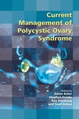 A policisztás ovárium szindróma jelenlegi kezelése - Current Management of Polycystic Ovary Syndrome