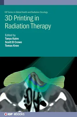 3D nyomtatás a sugárterápiában: Személyre szabott hardver a sugárterápiában - 3D Printing in Radiation Therapy: Personalized Hardware for Radiation Medicine