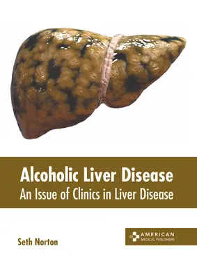 Alkoholos májbetegség: An Issue of Clinics in Liver Disease (A májbetegségek klinikái) - Alcoholic Liver Disease: An Issue of Clinics in Liver Disease