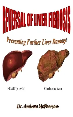 A májfibrózis visszafordítása: A további májkárosodás megelőzése - Reversal of Liver Fibrosis: Preventing Further Liver Damage